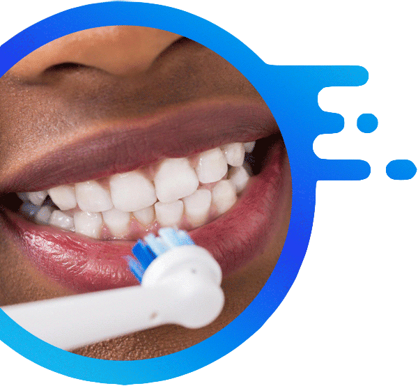 teeth-whitening-karen-dental-nairobi